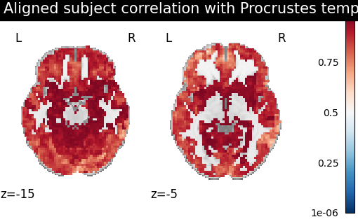_images/sphx_glr_plot_template_alignment_002.png